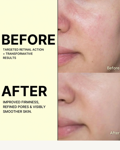 The Vita-A Retinal Shot Tightening Booster — 15 ml